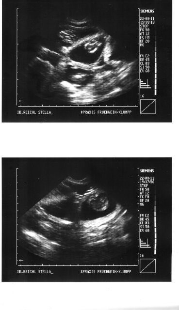 Ultraschallbild Stella B- Wurf
